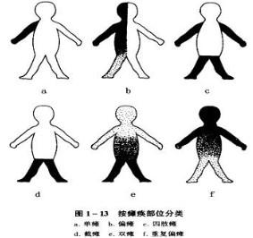 肢体障碍是因肢体器官损伤或功能缺陷而导致的肢体活动困难.