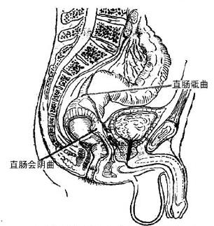 慢性支气管炎引起慢性咳嗽等因素,均可致直肠脱垂