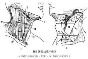 口咽部可分为舌根,扁桃体区,软腭腹侧和咽后壁四个部分,各部发病和