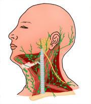 淋巴结肿大