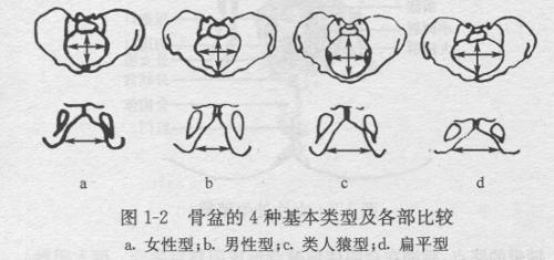 骨盆侧壁直,坐骨棘不突出,耻骨弓较宽,坐骨棘间径≥10cm.; 耻骨弓