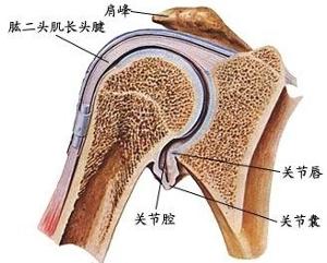 退行性关节炎