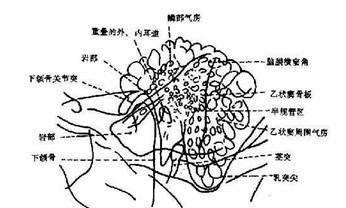 急性化脓性乳突炎