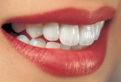 牙齿整形方法是在不影响正常生活的情况及美观的情况下让您在更短的