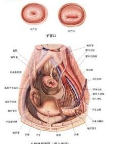 盆腔炎的发病一般是怎么造成的呢;; 子宫口女性盆腔器官(前上面观)