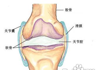 膝关节积水