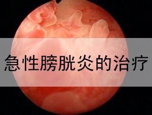 嗜酸性粒细胞性膀胱炎