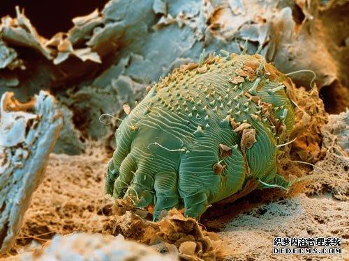 从艾滋病病毒侵入人体