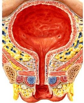 尿道肉阜 为发生于女性尿道口部位的良性息肉样组织.