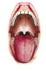 舌体大且表面有沟纹