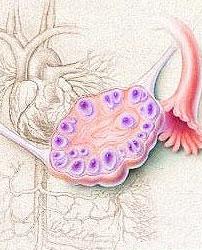 多囊卵巢综合征怎么治疗最好方法