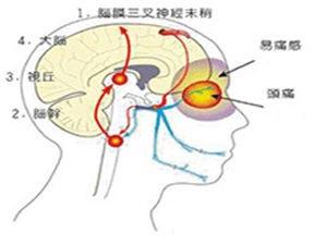 头痛为搏动性 - 搜狗百科