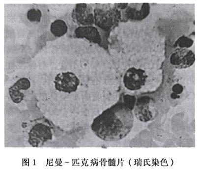 尼曼-皮克病