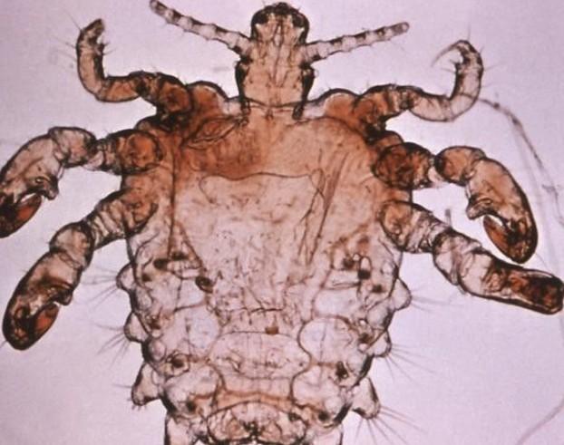 阴虱-+搜搜百科