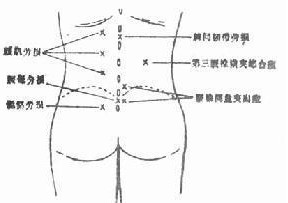 患者诉说疼痛部位有时和病变不一致,胸腰段病变的患者常诉腰骶部疼痛.