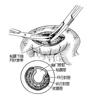 括约肌功能障碍