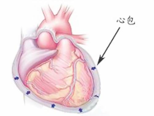 心包炎-+搜搜百科
