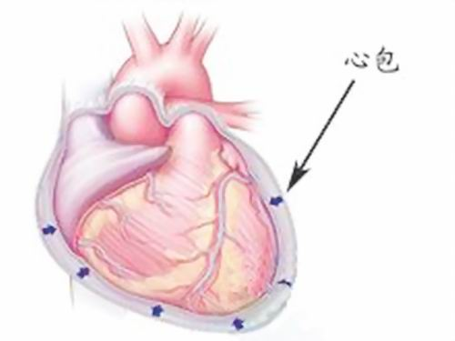 心包转移