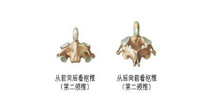 寰横韧带,但此韧带较细小;齿突前面有一关节面与寰椎前弓构成寰齿关节