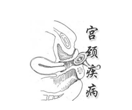 白带异味+-+搜狗百科