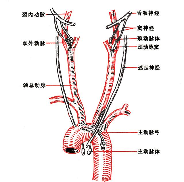 颈动脉窦过敏综合征