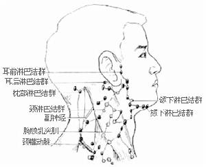 锁骨上及前斜角肌淋巴结肿大