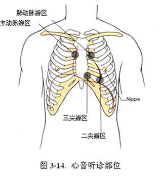 心尖部第1心音亢进