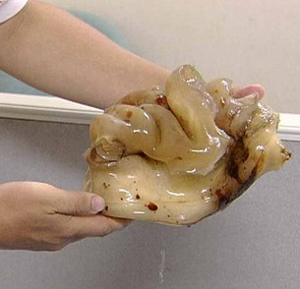  太岁  - 搜搜百科