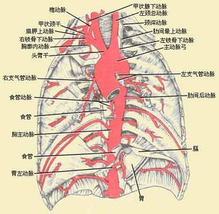 胸主动脉瘤切除术