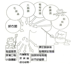 <em>急性尿道炎</em>