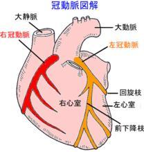 缺血性心脏病是指心脏肌肉因冠状动脉狭窄而血液循环不足所导致的症状