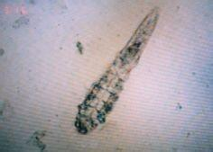 毛囊虫又称蠕形螨,寄生于多种哺乳动物,包括人的毛囊和皮脂腺中,是一