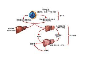 乙肝大三阳+-+搜狗百科