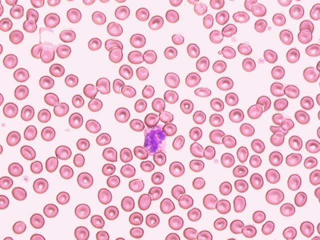 红细胞计数(rbc)