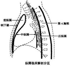 纵隔肿瘤及囊肿