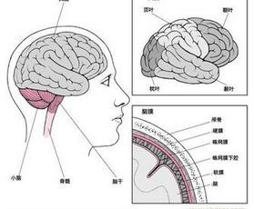 桥小脑角脑膜瘤
