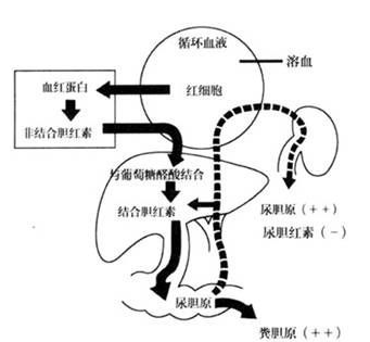 发病机制 红细胞大量破坏时,生成过量的间接胆红素,远超过肝细胞摄取