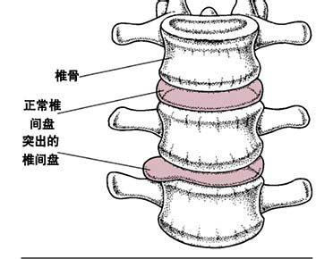 腰椎示意图