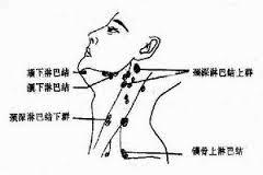全部版本 历史版本  体表淋巴结主要分布于枕部,颌下,颈部,锁骨上