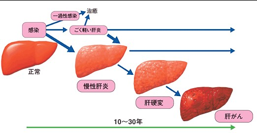 治疗:这类药物只适用于治疗乙型肝炎,包括慢性乙型肝炎和乙肝肝硬化