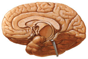 纹状体小脑钙化伴白质营养不良综合征-+搜搜百