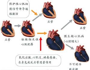 围生期心肌病