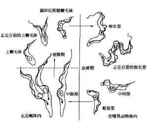 美洲锥虫病