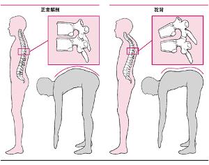 矫正练习的目的是加强背部伸肌的力量,并牵拉胸部前面的韧带.
