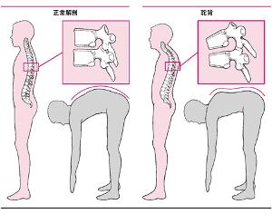 胸椎12节位示意图