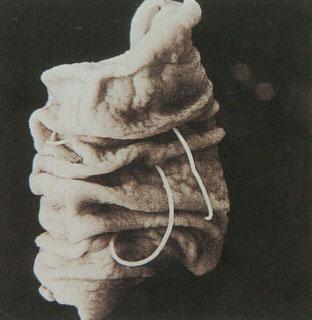 但东南沿海的近海鱼类异尖线虫第三期幼虫