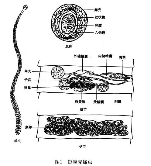 微小膜壳绦虫病