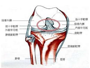 后十字韧带损伤