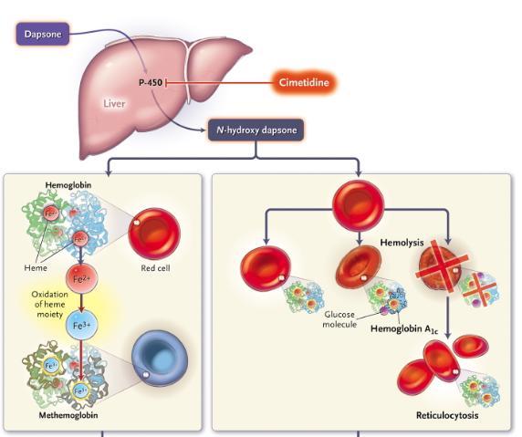 遗传性高铁血红蛋白血症-+搜搜百科