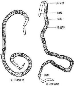 内脏蠕虫蚴移行症